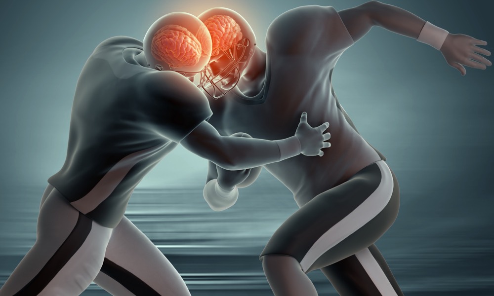Understanding The Effects Of Concussion To Football Players